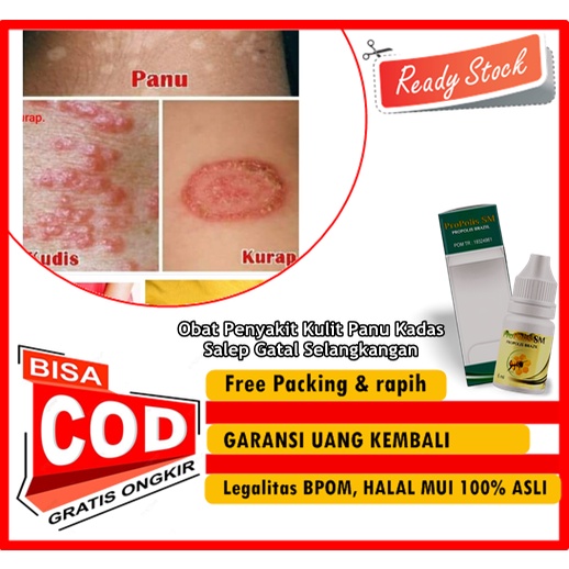 Jual Propolis Sm Obat Penyakit Kulit Panu Kadas Salep Gatal