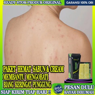 Jual Obat Biang Keringat Obat Gatal Gatal Biang Keringat Paket Sabun