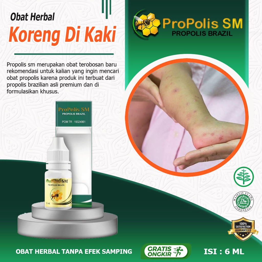 Jual Propolis SM Obat Koreng Di Kaki Kepala Pantat Bernanah Dermatitis