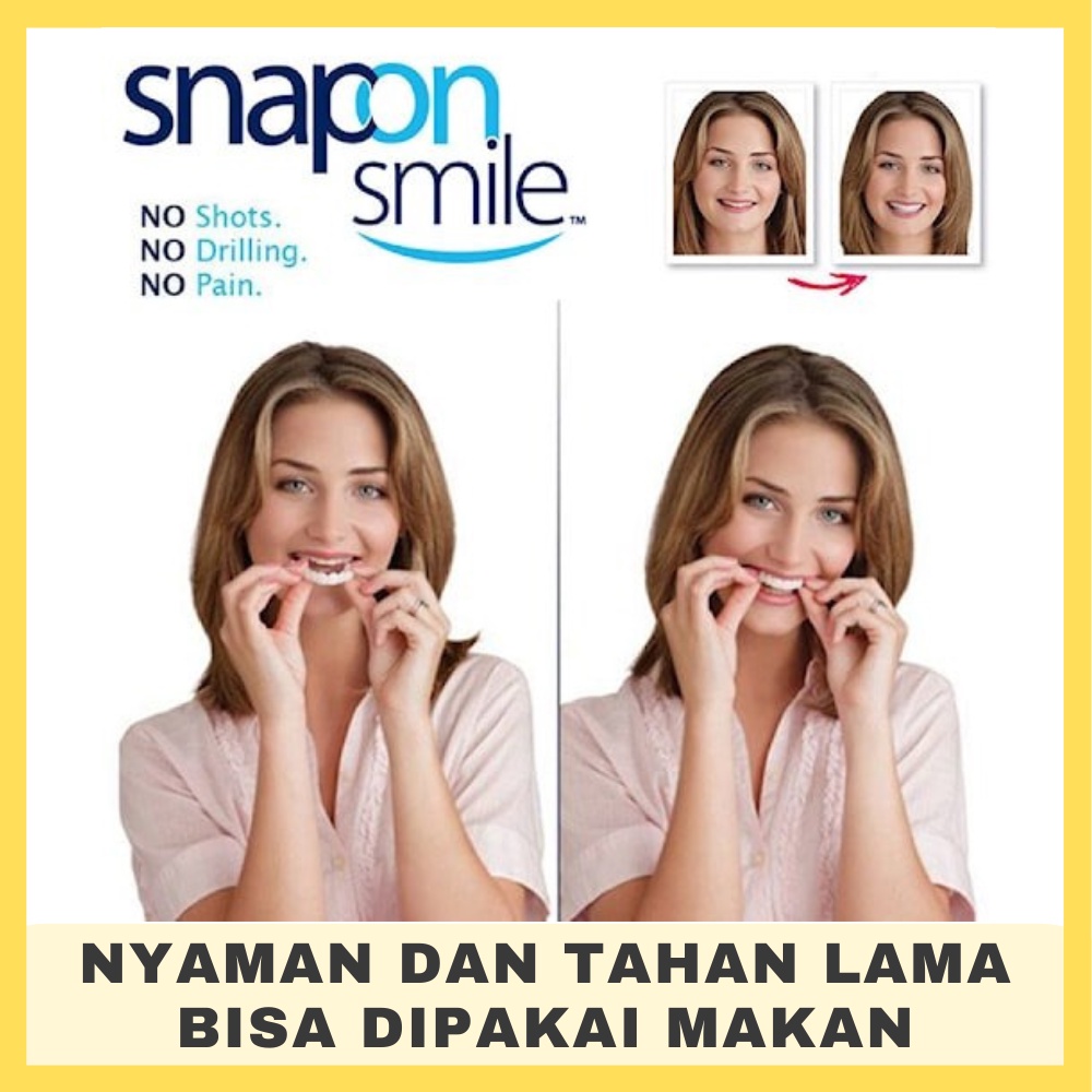 Jual Snap On Smile Original Gigi Palsu Instan Atas Bawah Bisa Buat