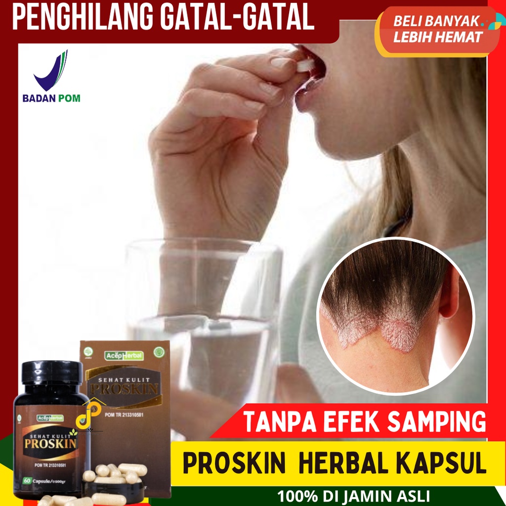 Jual Proskin Herbal Obat Gatal Yang Diminum Obat Gatal Kulit Kering