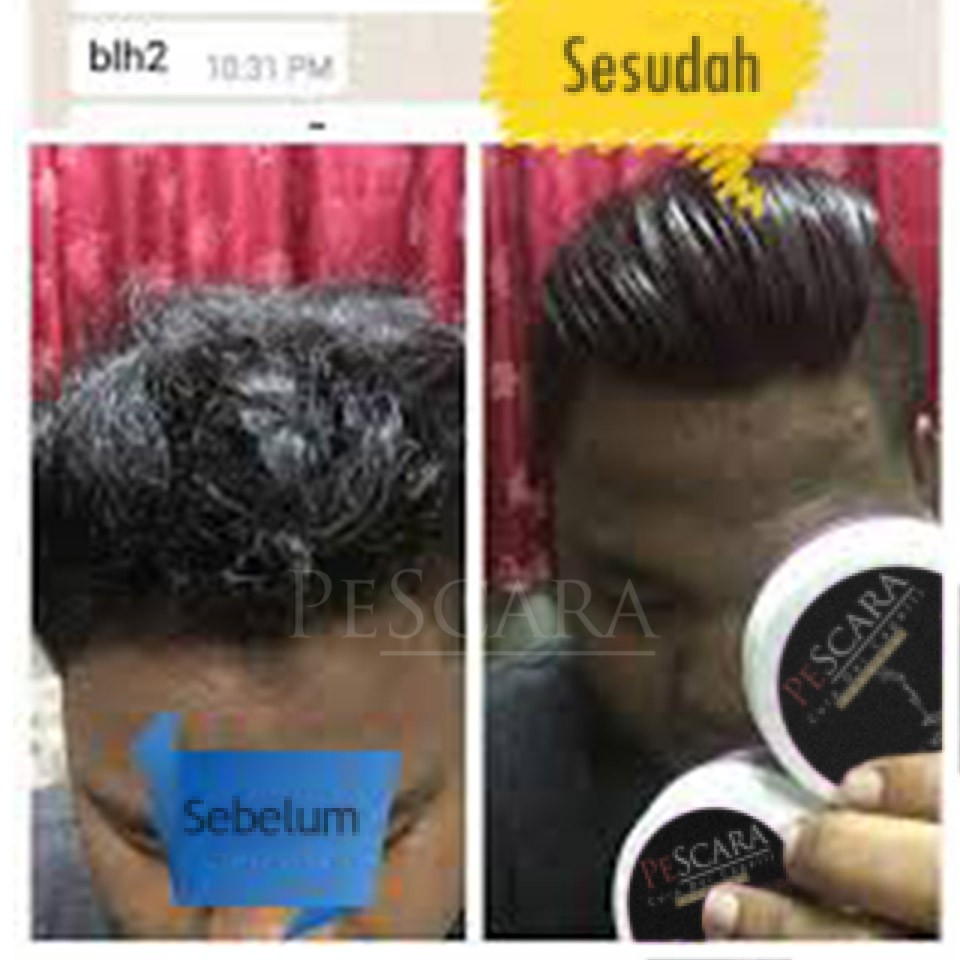 PELURUS RAMBUT PRIA PeScara STRONG FORMULA / OBAT PELURUS RAMBUT 