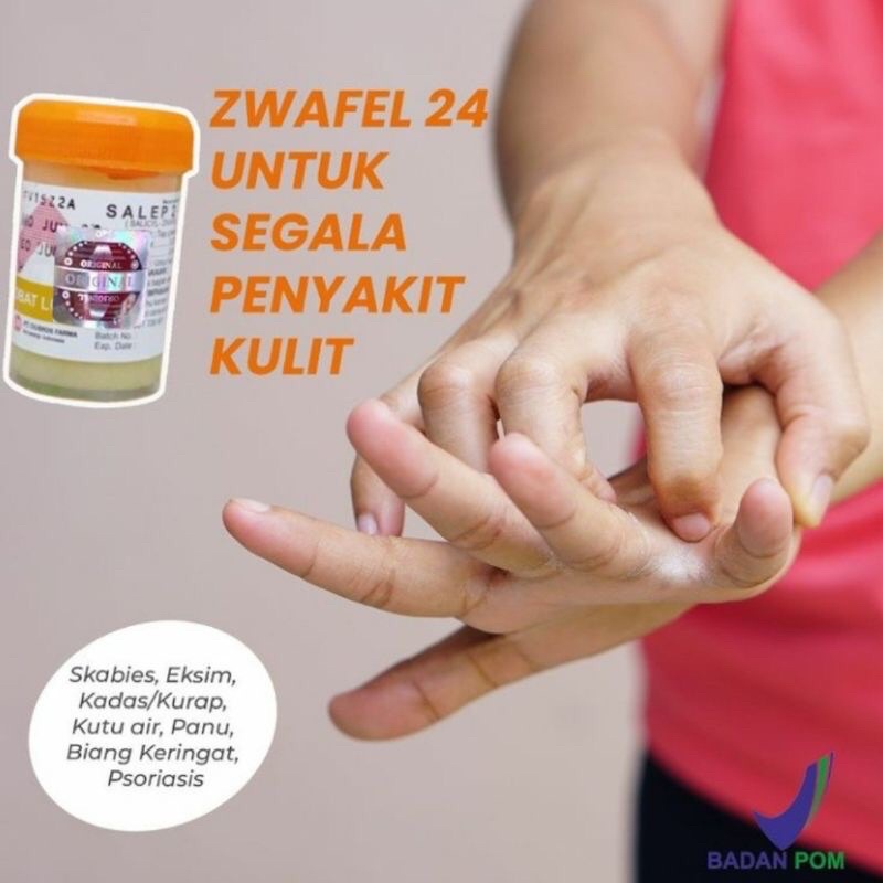 Salep Gatal Zwafel 24 Original 100% | Obat Saleb Gatel Panu Kadas Kurap Kutu Air Eksim