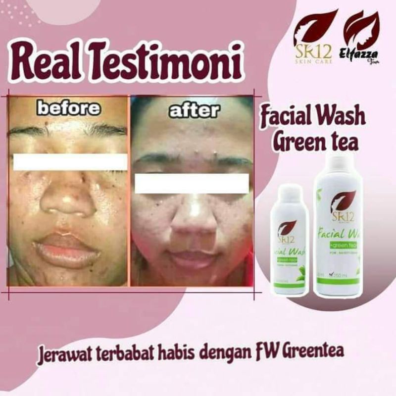 

SR12 Facialwash Greentea (100ml)//Kulit Berjerawat//Sensitif