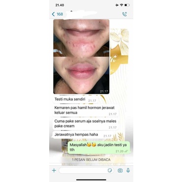 Mr Glow Serum Glowing semua jenis kulit produk ORI 100%