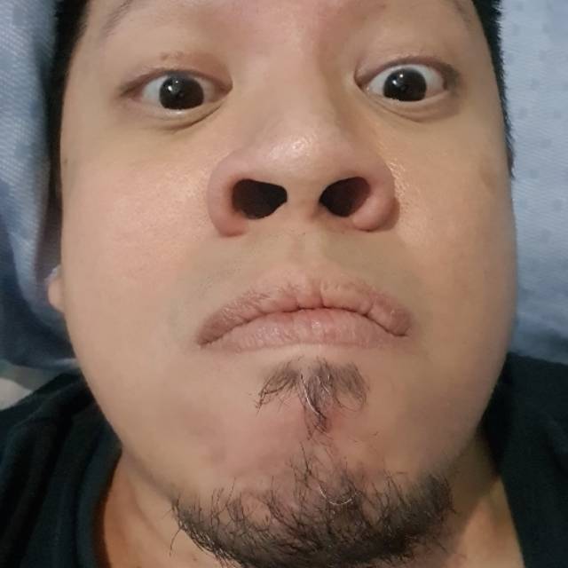 b*****2