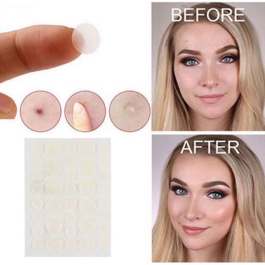 Acne Patch Pimple Blemish Removal Stickers Breathable Pimple Blemish Removal Sticker Facial Care 36 patches Acne Pimple