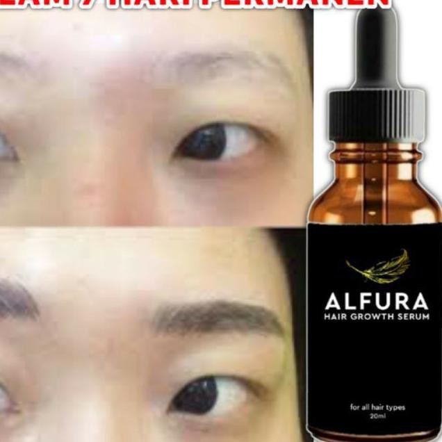 ◌ [BISA ] TOP NO 1 SERUM PENUMBUH RAMBUT ALFURA ☂