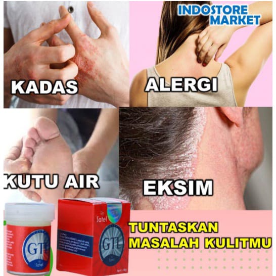 Salep Gatel Premium GTL Jaminan Atasi Penyakit Kulit Gatal Kudis Kurap Panu Kutu Air Eksim Jerawat-1