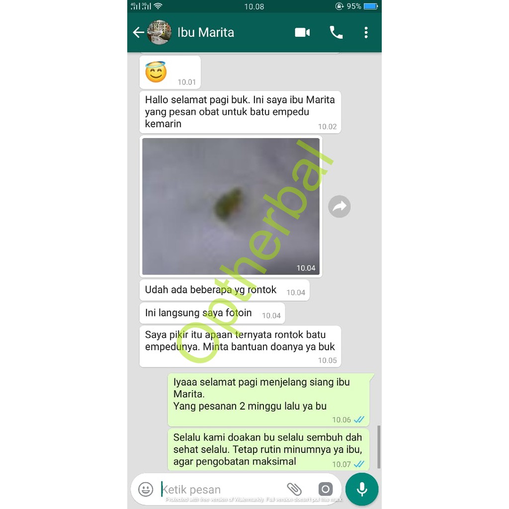 Obat Herbal Khusus Batu Ginjal Dan Batu Empedu-8