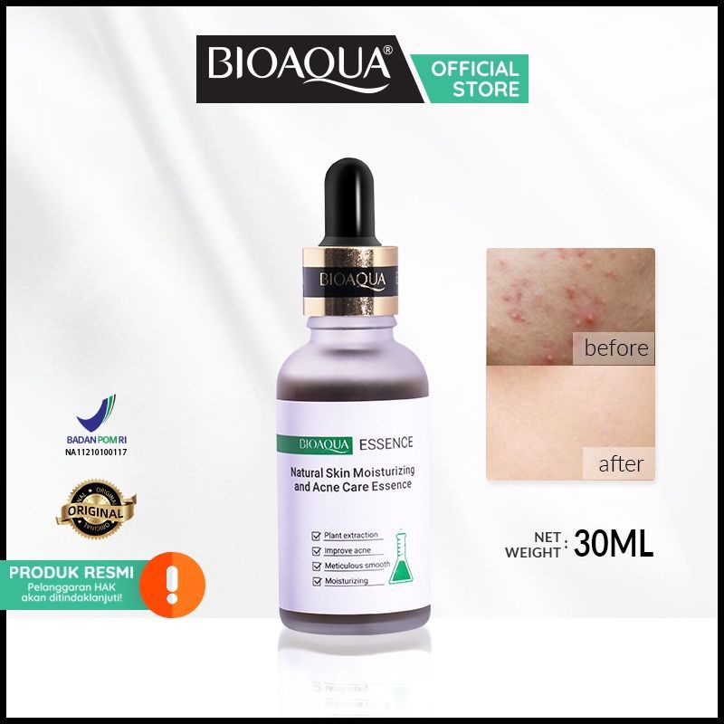 [ 𝗕𝗣𝗢𝗠 ] BIOAQUA ESSENCE SERUM 30ml FOR NATURAL SKIN AND ACNE CARE