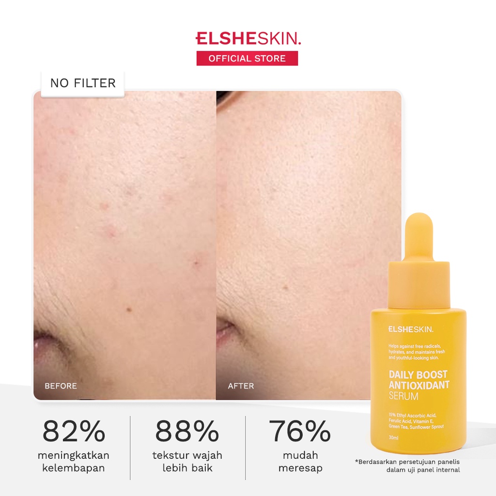 ELSHESKIN Daily Boost Antioxidant Serum Vitamin C (Kulit 8x Lebih cerah) 15 ml / 30 ml