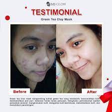 Ms Glow Masker Clay Mask Green Tea Charcoal Original 100% Masker Oles Pencerah Wajah Dan Penghilang Debu Ms Glowms Glow