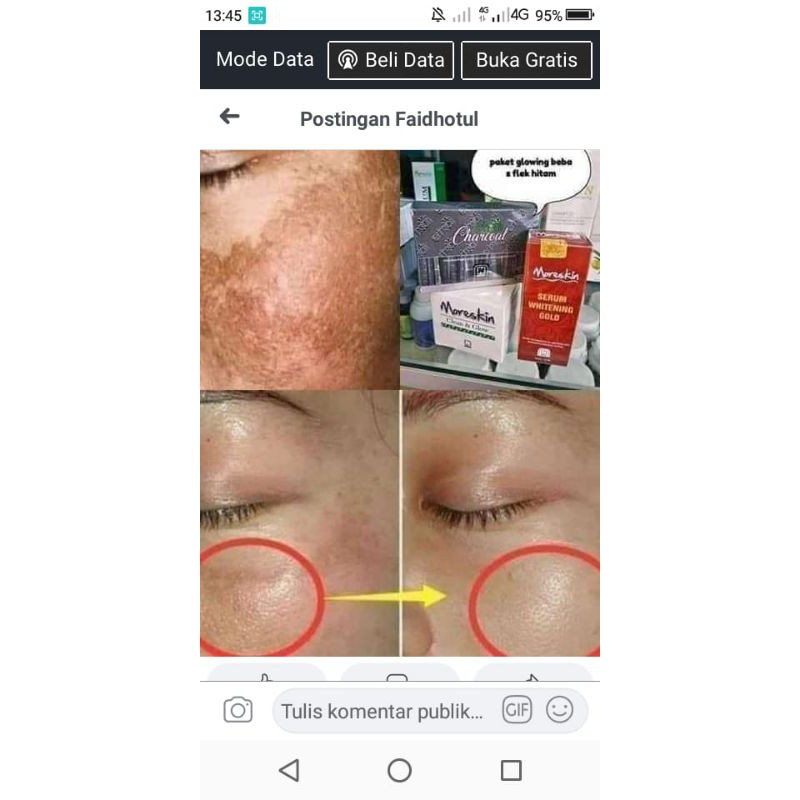 paket flek bandel