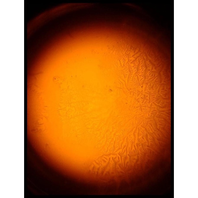 [[BISA COD]] Diskon  Ovutest Scope - Alat Uji Masa Subur Bisa Dipakai Berkali-Kali