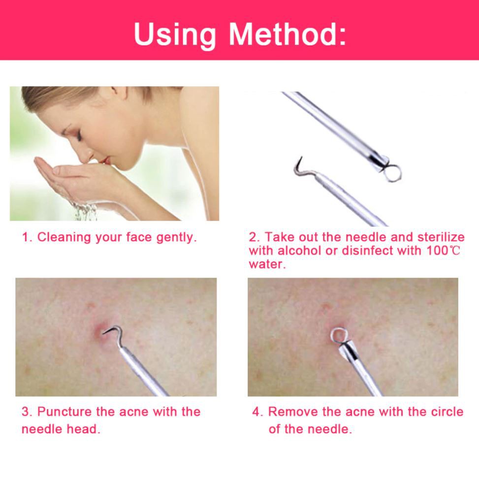 Komedo, jerawat dan set jarum komedo Set jerawat stainless steel    Acne removal needle set