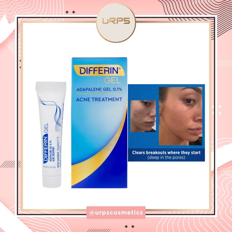 Differin Adapalene Gel 0.1% Acne Treatment 15g