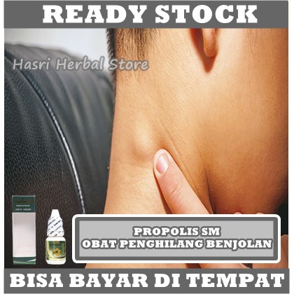 Obat Penghilang Benjolan Di Leher Herbal Asli 100% Alami - Obat Kelenjar Getah Bening - Obat Benjolan Di Tangan - Obat Benjolan Lipoma - Obat Kelenjar Tiroid Bengkak - Obat Gondok Beracun - Obat Pembengkakan Kelenjar Getah Bening - Obat Leher Bengkak