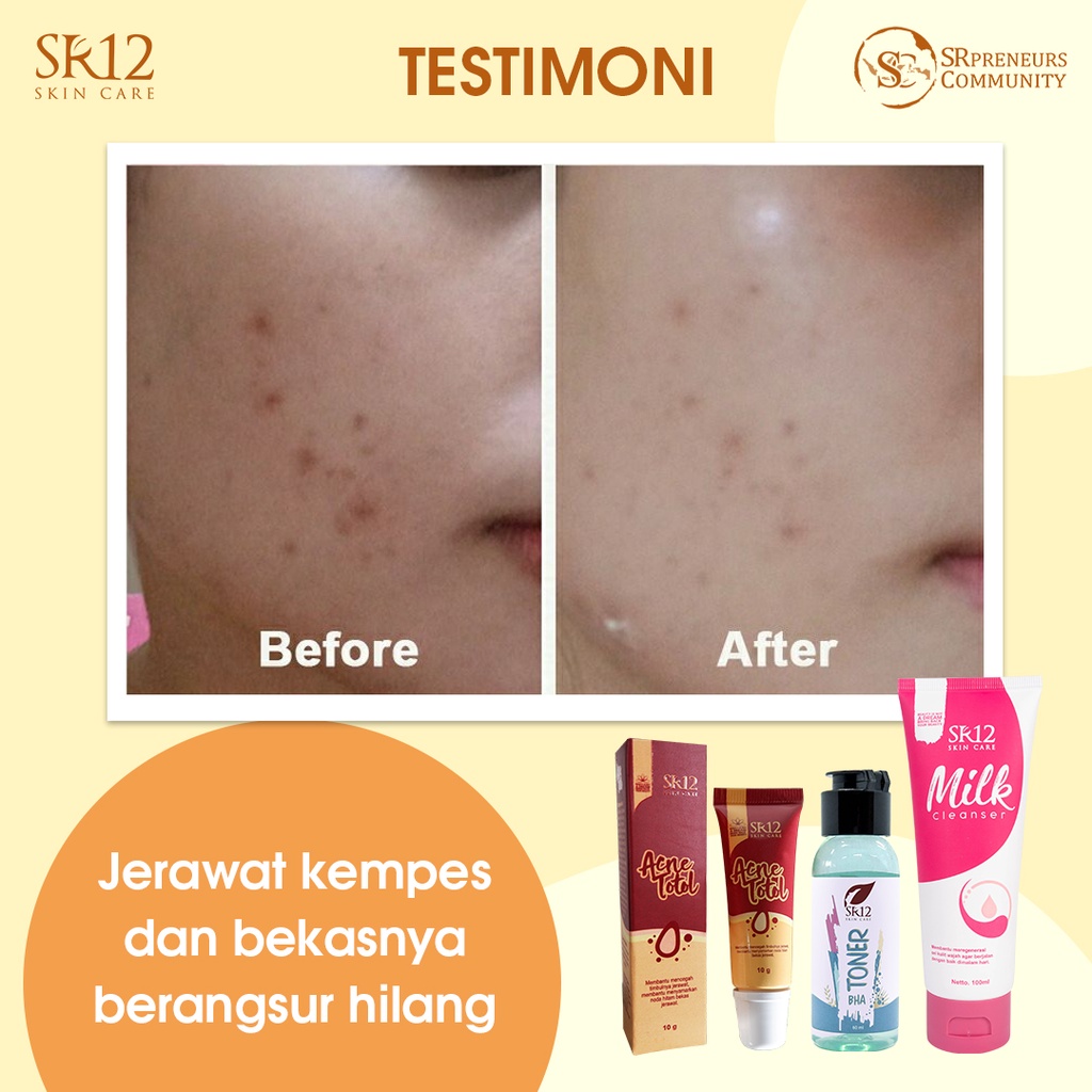 BEST SELLER MILK CLEANSER SR12 | SUSU PEMBERSIH WAJAH PREMIUM ALAMI BPOM | AMPUH MEREGENERASI SEL KULIT WAJAH