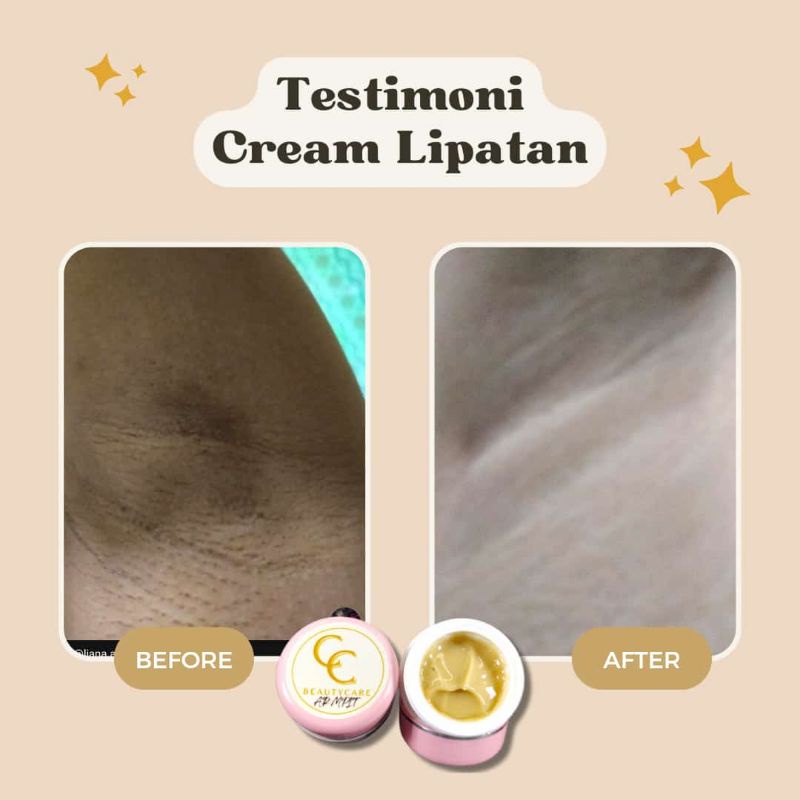 CC BEAUTYCARE Cream Lipatan Armpit Underarm