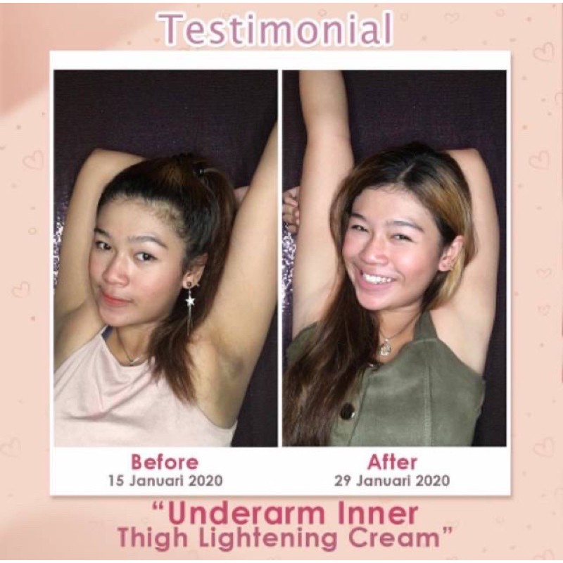 MS GLOW UNDERARM / UNDERARM MS GLOW INNER LIGHTENING