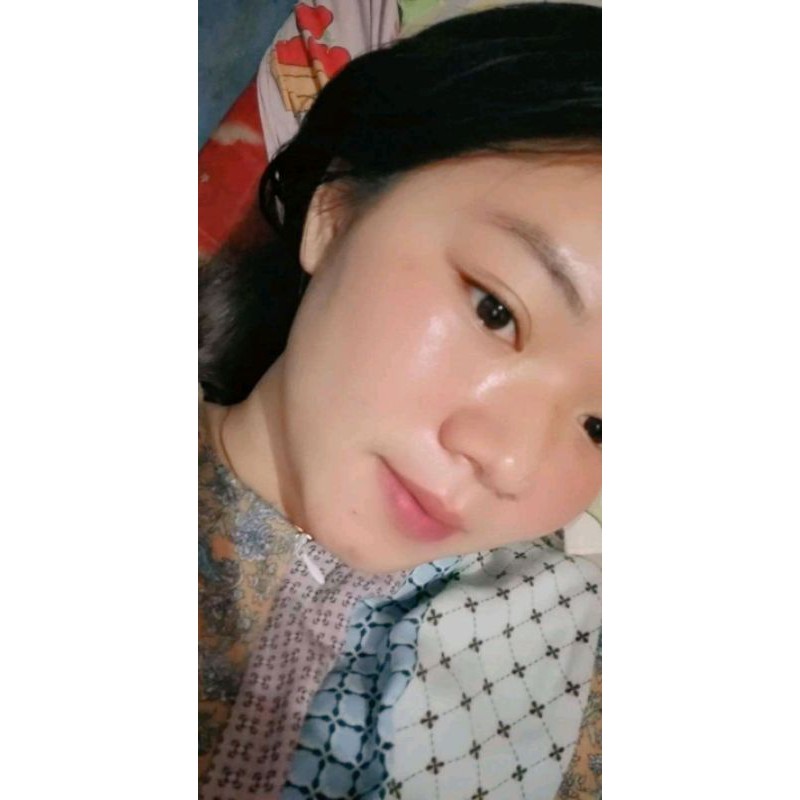 zaviera acne