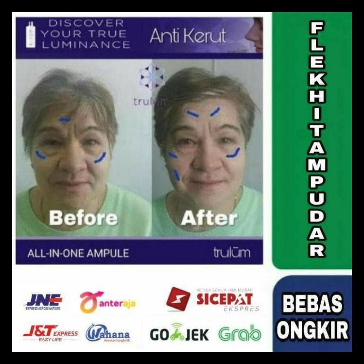 

Indonesia Fresh 2020 Mengurangi Kerutan Wajah | Pengganti Krim Jerawat Paling Ampuh