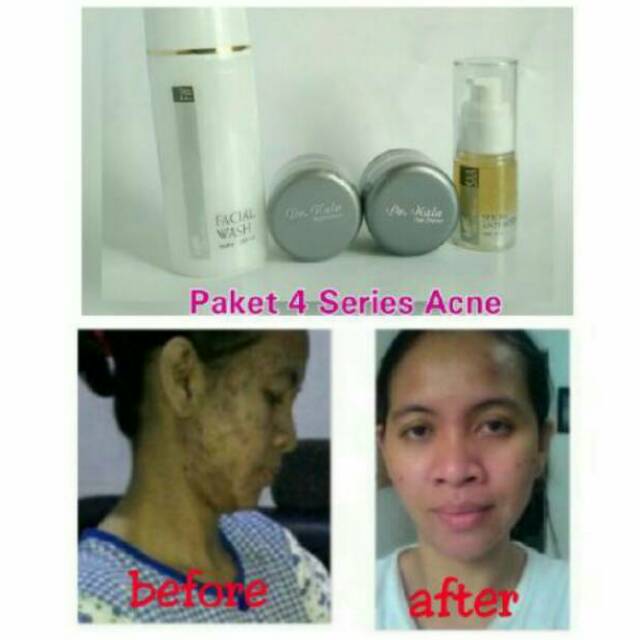 Dr.Nala whitening cream pkt 4 series