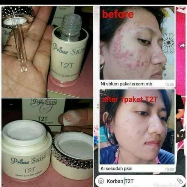 T2T CREAM DAN SERUM ORIGINAL HWI