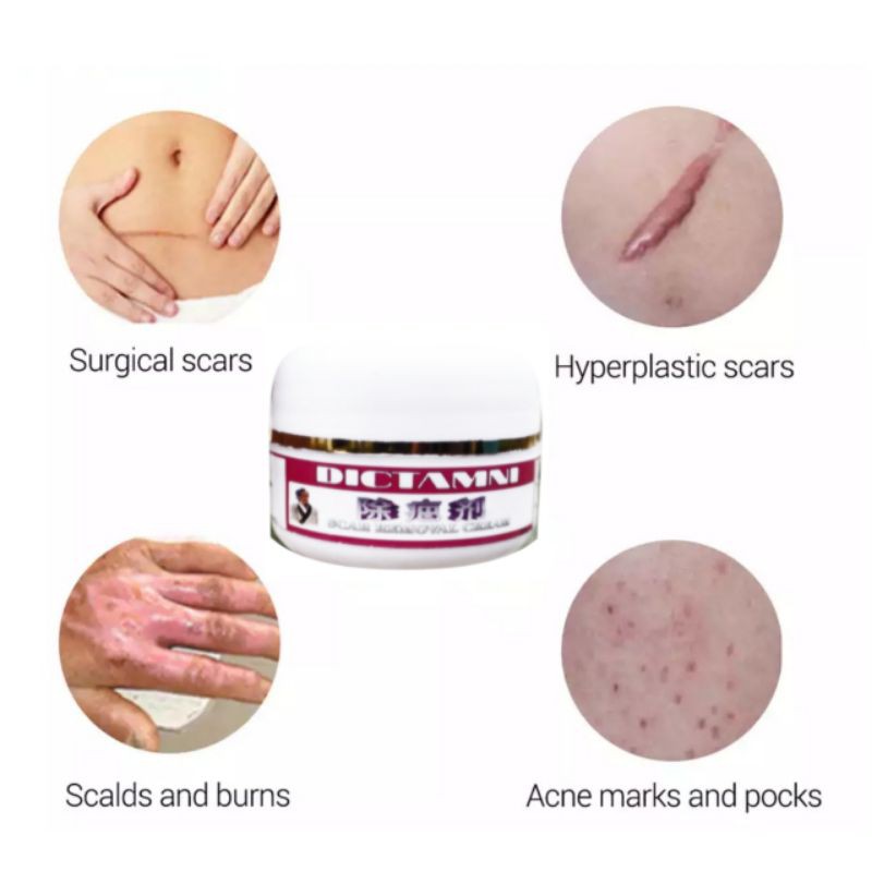 CREAM PENGHILANG KELOID BEKAS LUKA DICTAMNI