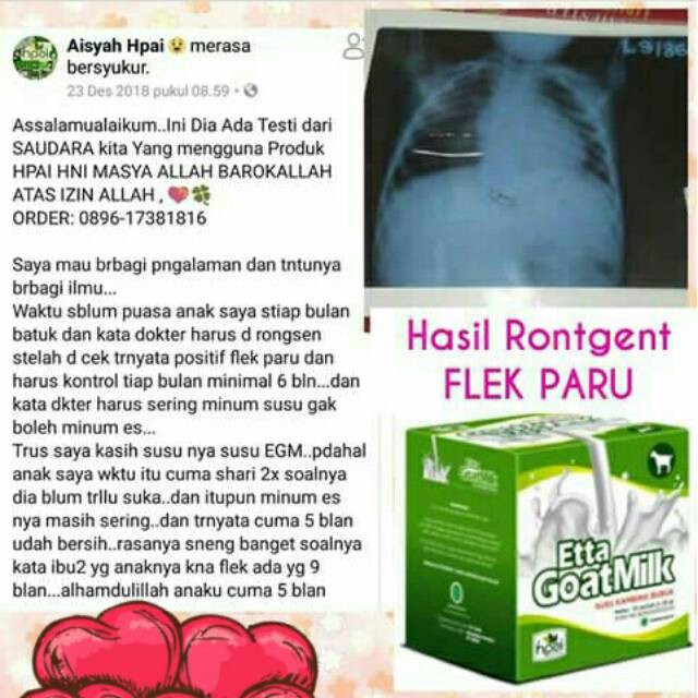 Etta Goat Milk Hni Hpai Egm Susu Kambing Hni Hpai Susu Kambing Etawa Ettawa Stokis Cimahi Shopee Indonesia