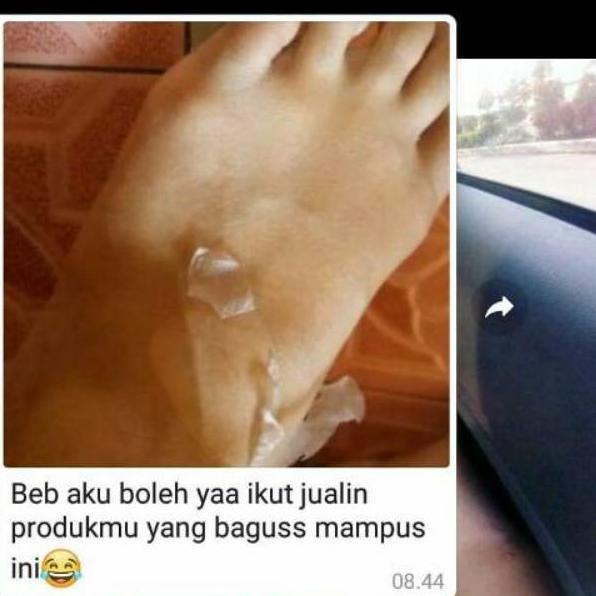 Barang Impor ❤ ERES ❤ INSTAN KOJIC 5X DOSIS TINGGI HB LOTION WHITENING PEMUTIH BADAN HANDBODY / TUBU