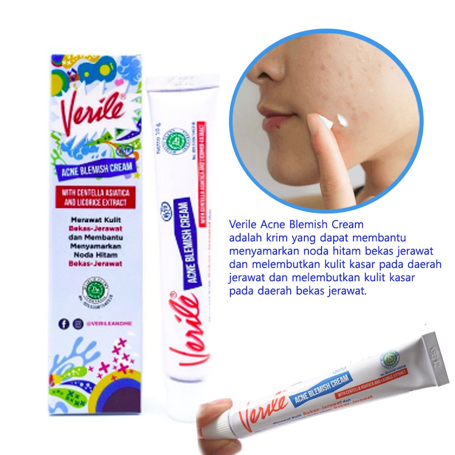 Verile Acne Blemish Cream Tube 10 gr Obat Bekas Jerawat