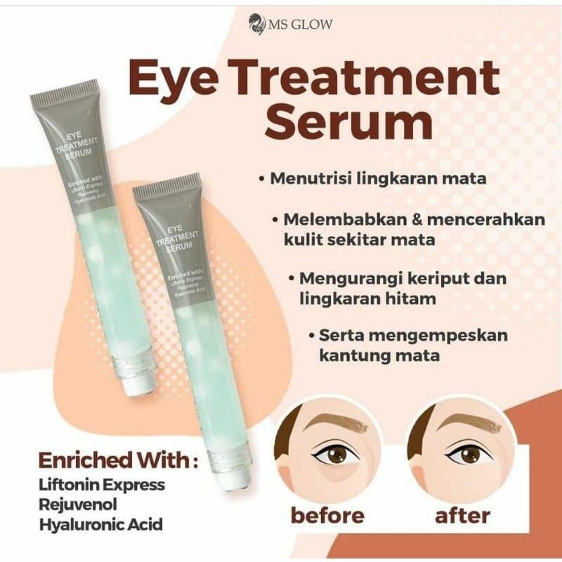 MS GLOW Eye Treatment Serum 15 gr ~ ORIGINAL 100%⁣⁣