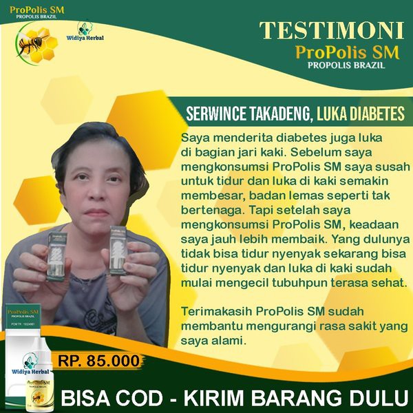 Obat Tetes Sakit Gula Diabetes Kencing Manis Herbal 100% Alami Propolis SM Original