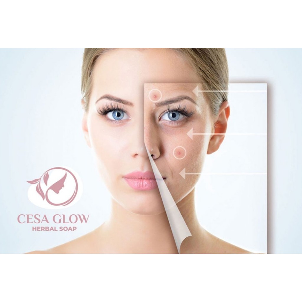 Cesa Glow Soap Sabun Glowing Herbal Cesa Herbal Soap Sabun Cesa beli 2 gratis 1