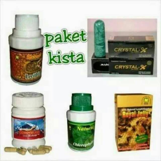 Produk kesehatan PT.NASA untuk Kista
