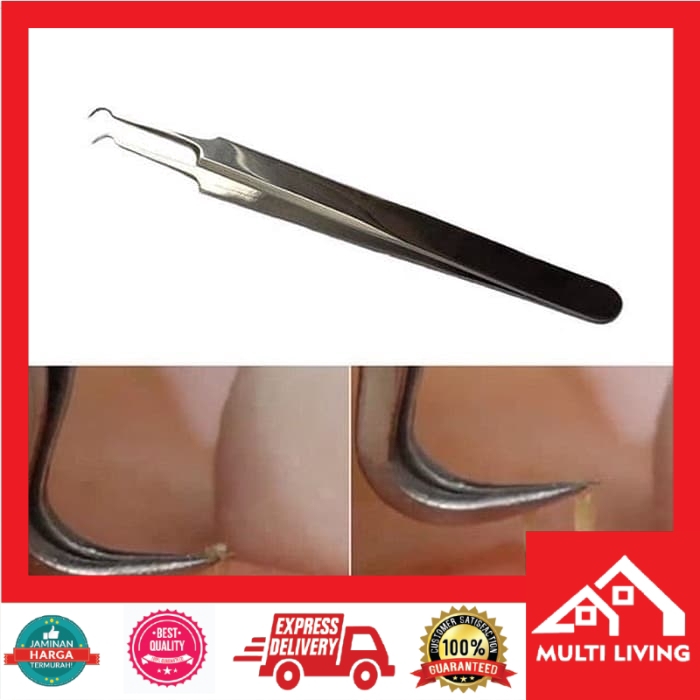 pinset komedo / BLACKHEAD TWEEZER