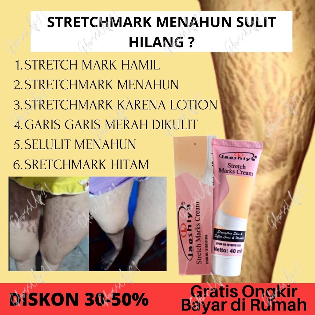 LAOSHIYA STRETCH MARKS CREAM ORIGINAL BPOM - STRETCH MARKS LAOSHIYA