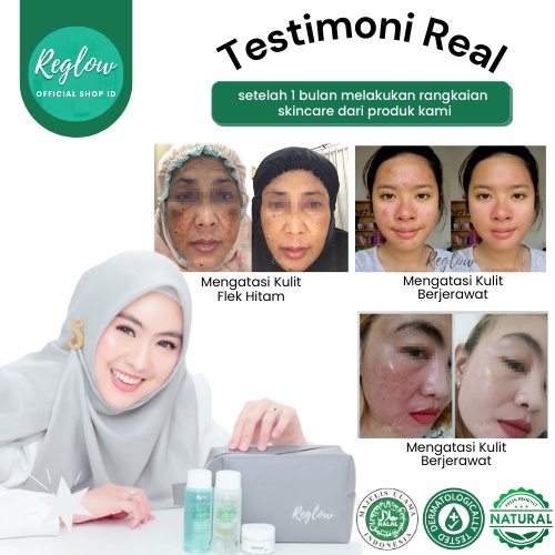 Skincare Reglow Doctor Shindy Putri Paket Acne Untuk Kulit Berminyak Berjerawat Bruntusan Pori Besar Wajah Glowing Penghilang Noda Hitam Komedo Milia Untuk Kulit Kering Sensitif Red glow Ori Official Store