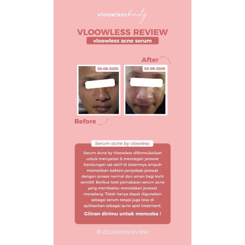 vloowless acne serum