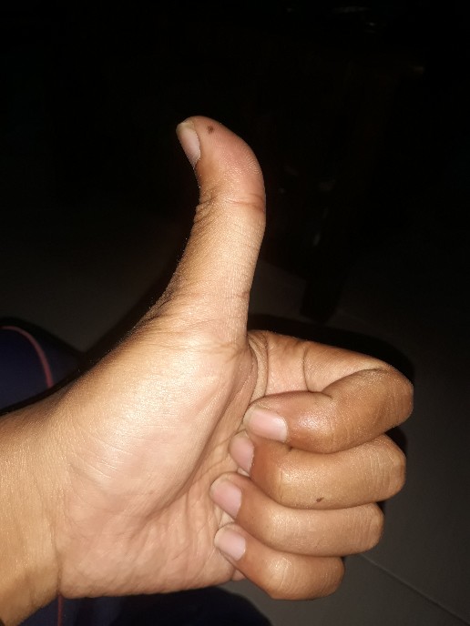 Baut 10 Obeng Payung 6x15 Serong Y