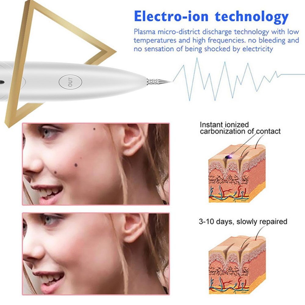 Alat Pen Laser Portable Plasma Penghilang Jerawat Tatto Bintik Bintik Hitam Dark Spot Wajah