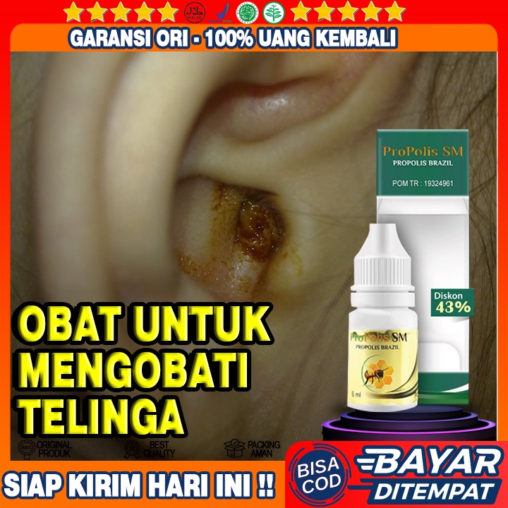 Obat Congek Telinga Bernanah, Obat Infeksi Telinga, Obat Curek, Obat Telinga Berdengung, Obat Congek