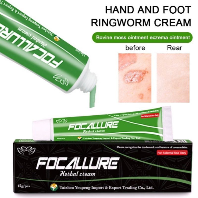 salep herbal yiganerjing focallure salep gatal eksim psoriasis