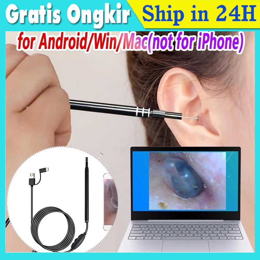 (Original) Earpick Camera HD/alat Pembersih Telinga Kamera/korek Kuping Kamera USB C Utk Exp Lama