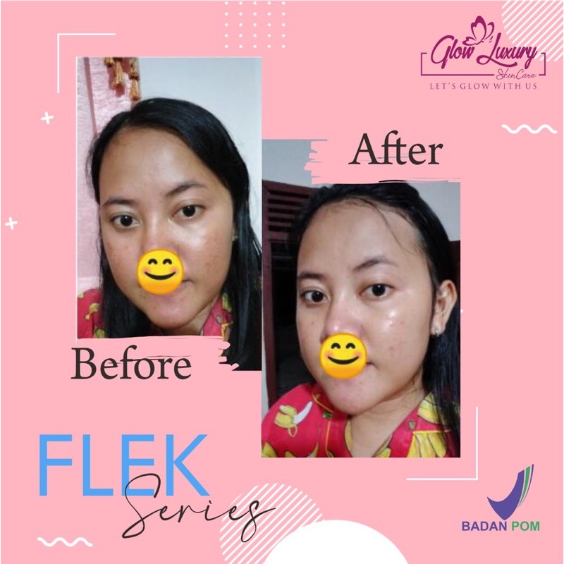 PAKET SERIES FLEK BASIC II GLOW LUXURY SKINCARE BPOM