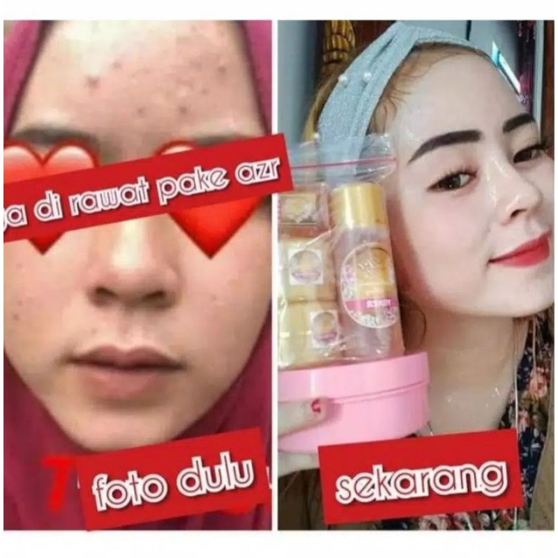 Cream azr beauty //glowing