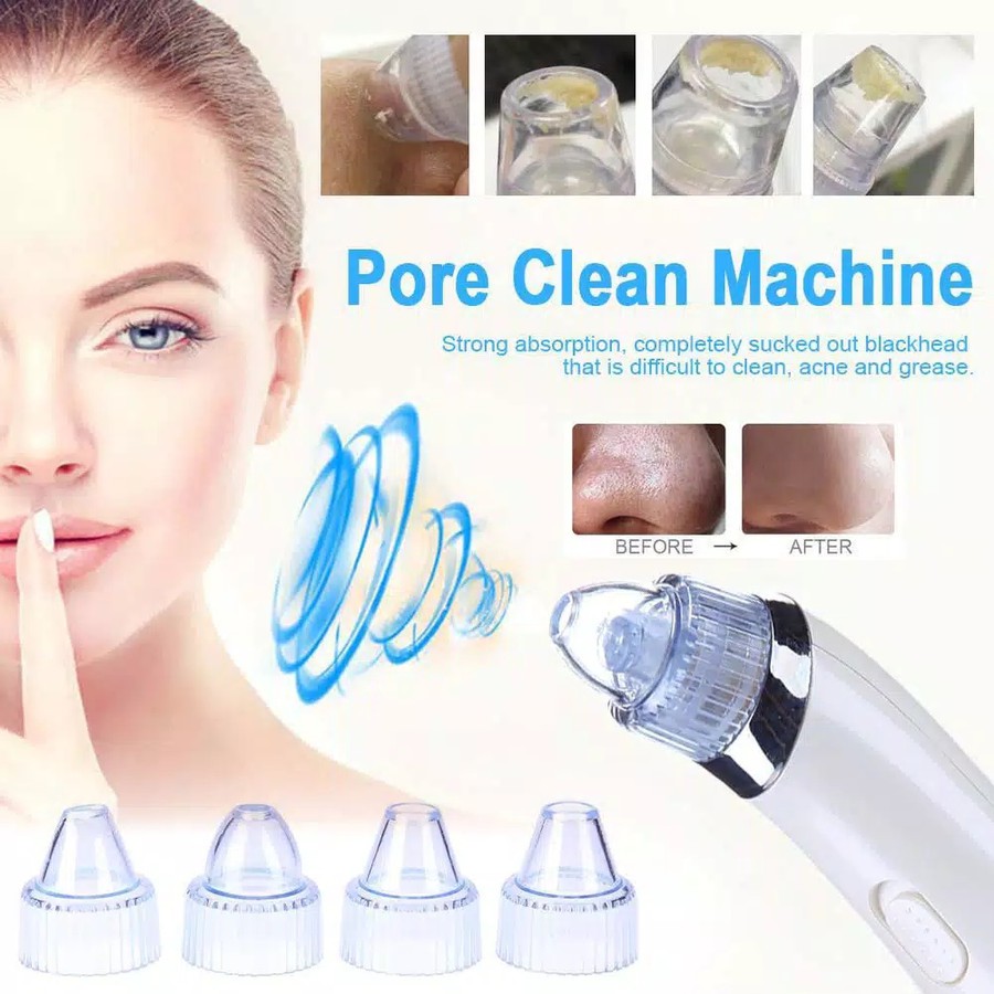 TBI Alat Mesin Skincare Tools - Penyedot Komedo Jerawat Vacuum Blackhead Whitehead