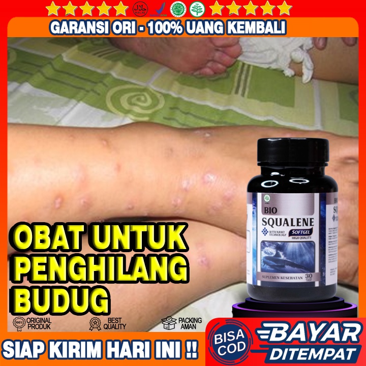 Obat Penghilang Budug - Obat Gatal Budug - Obat Scabies Paling Alami - Obat Budug Dewasa - Obat Budu